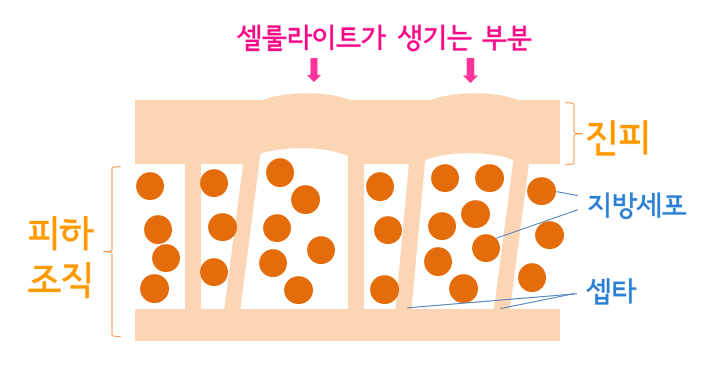 셀룰라이트 구조
